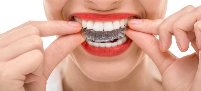 Сколько длится ретенционный период