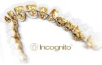 Брекеты Incognito – незаметное и комфортное лечение прикуса