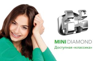 Брекеты Mini Diamond