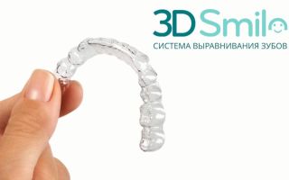 Особенности капп 3D Smile